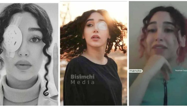 چشمای نیلوفر آقایی جوانه زد