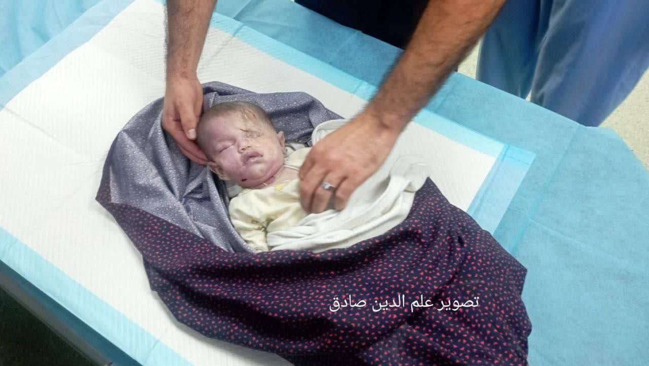 طفل شهید یحیی الاستال در حمله موشکی رژیم
