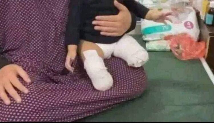 تصویری از جنایت صهیونیست‌ علیه کودکان
