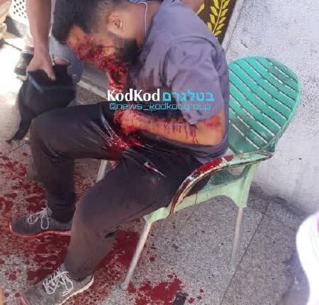 وزیر بهداشت لبنان: تعداد شهدا به ۱۱ نفر و ۴۰۰۰ زخمی رسید