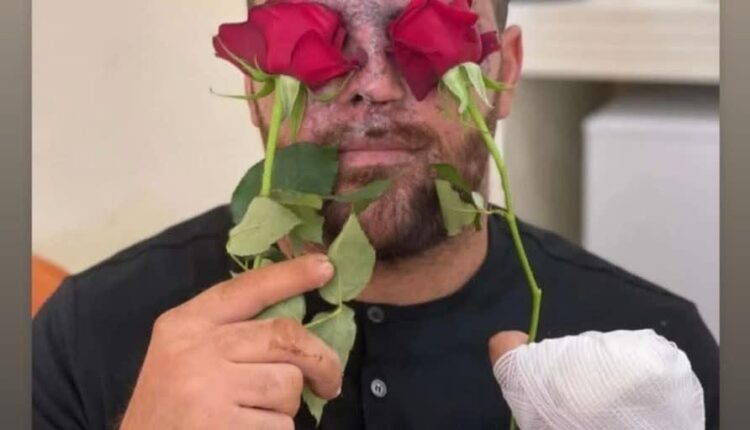 از جانبازان حزب الله ذر حادثه انفجار پیجرها