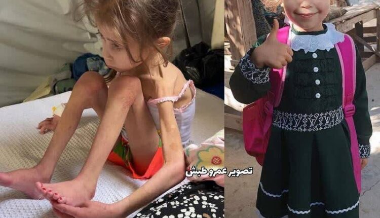 محاصره غذایی کودکان غزه توسط صهیونیست‌ها