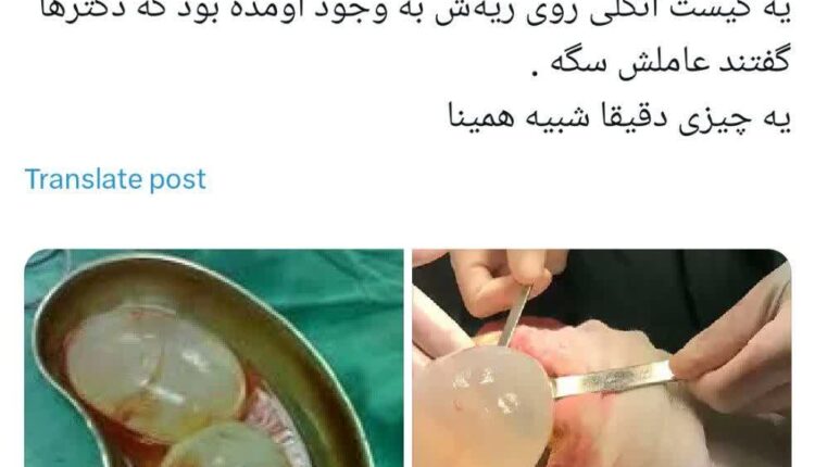 سگ خانگی باعث مرگ دختر نوجوان شد
