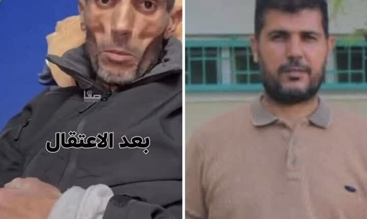 تغییر چهره شوکه‌کننده اسیر فلسطینی بعد از یک سال اسارت
