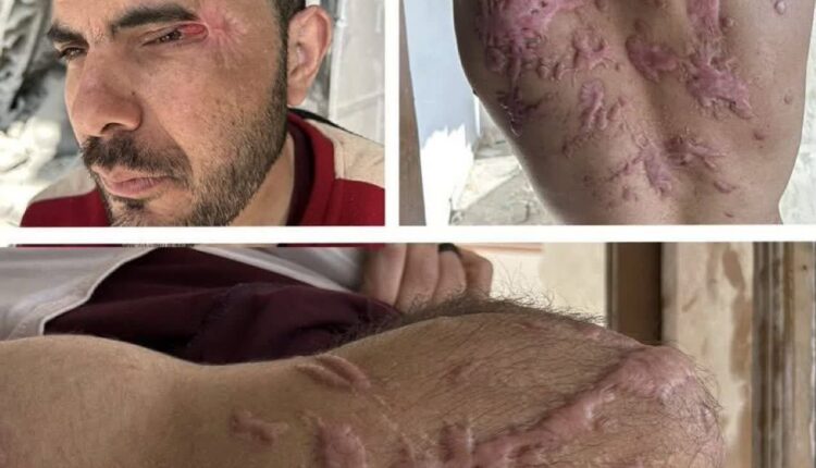 اثرات شکنجه وحشیانه بر زندانی آزاد شده محمد ابوطلحه
