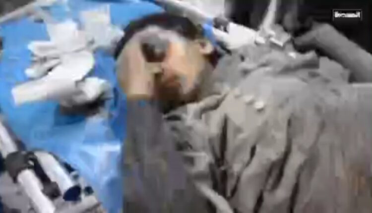 ۳۱ شهید و ۱۰۱ مجروح در حمله آمریکا به یمن