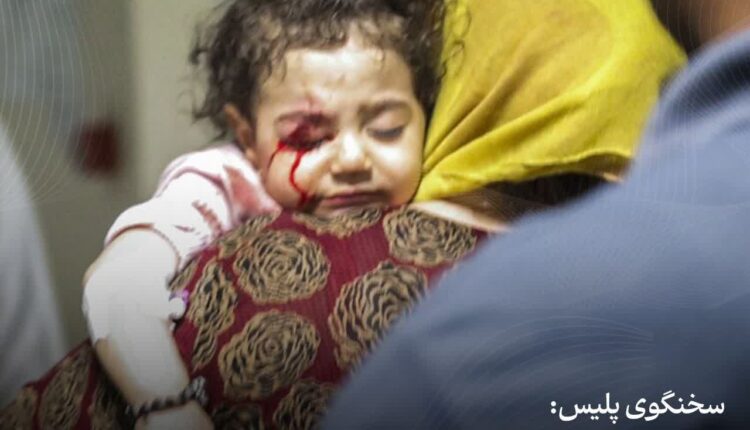 ۶۷ درصد مصدومان چهارشنبه‌سوری زیر ۱۸ سال سن دارند