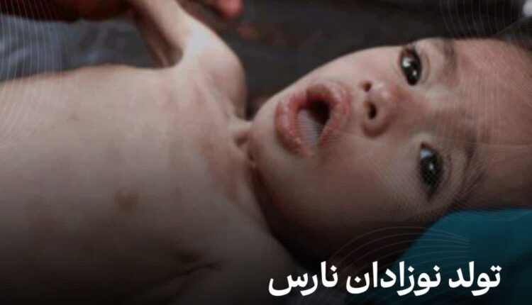 تولد نوزادان نارس با تغییرات ژنتیکی بی‌سابقه در غزه